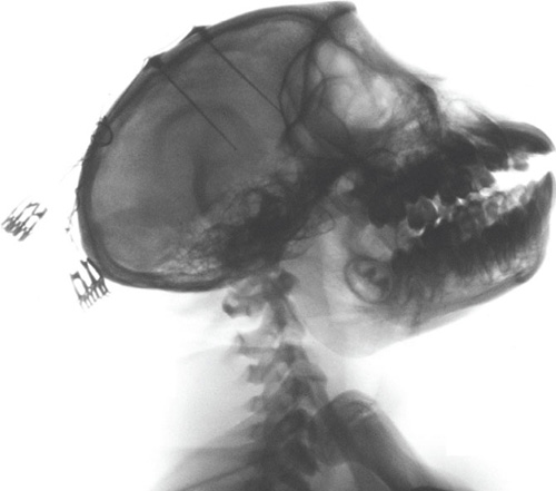 File:Delgado-monkey-brain-chip-silhouette.jpg