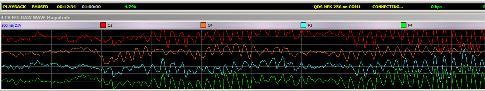 File:Alpha-synchrony-shown-in-red-derek-zumbach.jpg