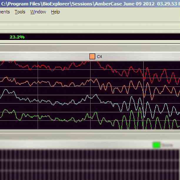 File:Transition-from-noise-to-alpha-synchrony.jpg